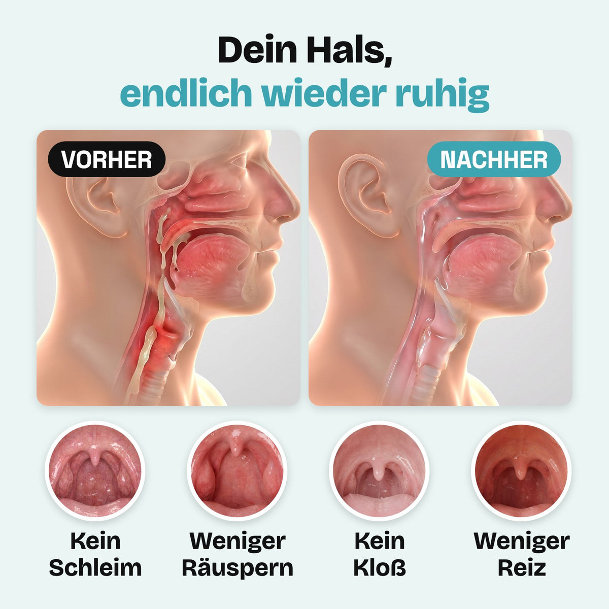 Dein Hals, endlich wieder ruhig: vorher und nachher