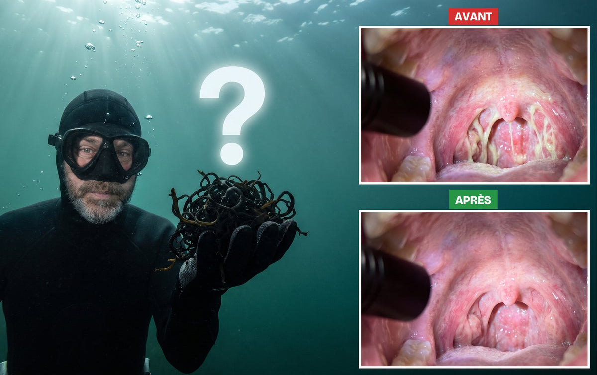 Un plongeur irlandais sous l’eau, en combinaison noire, tient de la mousse noire dans sa main ouverte, sous un grand point d’interrogation. À droite, la même gorge AVANT (rouge, pleine de mucus) et APRÈS (propre et calme)