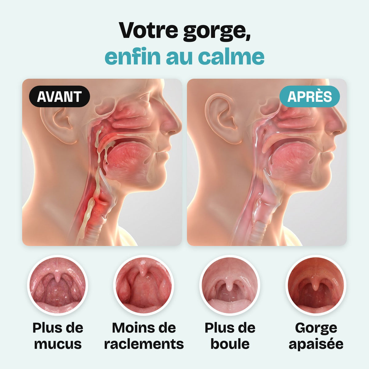 Votre gorge, enfin au calme : avant et après