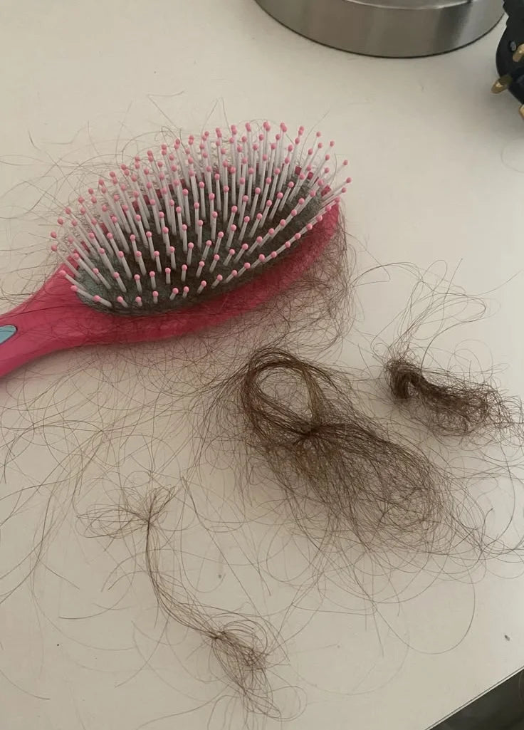 Gesündere Kopfhaut & weniger Haarausfall