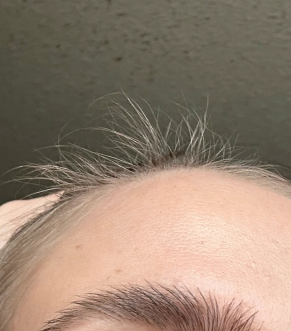 Neue Babyhaare & erstes Nachwachsen