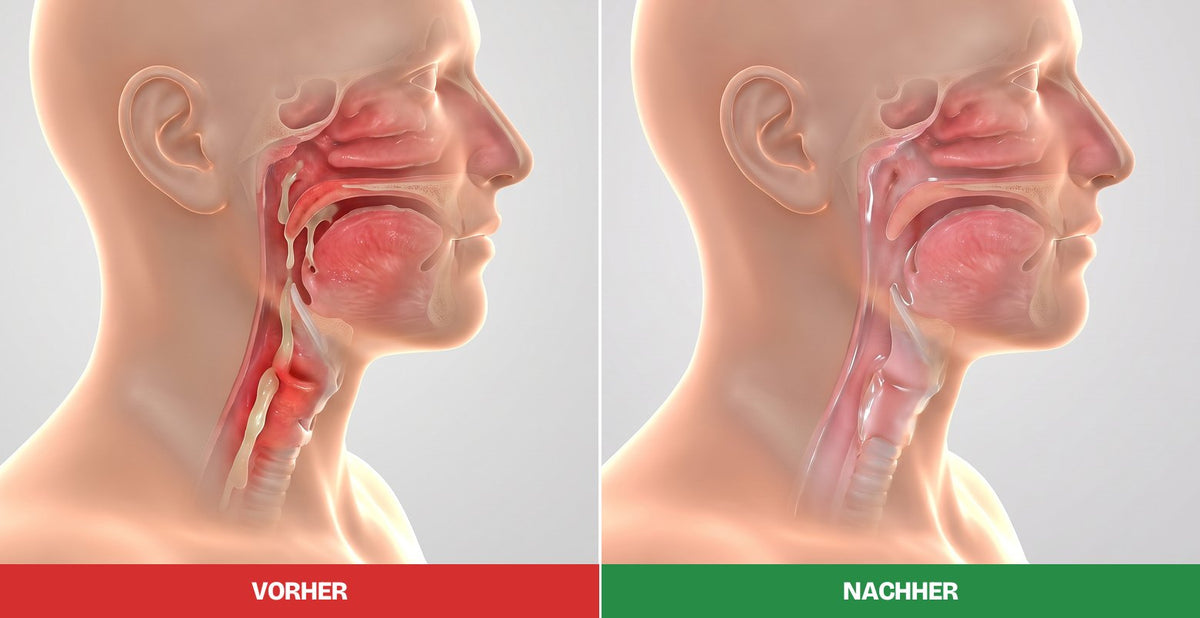 Derselbe Hals als 3D-Anatomie-Bild von der Seite: links rot und voller Schleim (VORHER), rechts ruhig und frei (NACHHER)