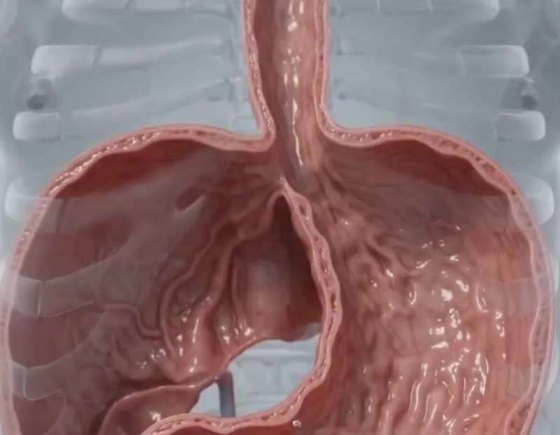 Un corpo di vetro: stomaco, esofago e la strada verso l'alto